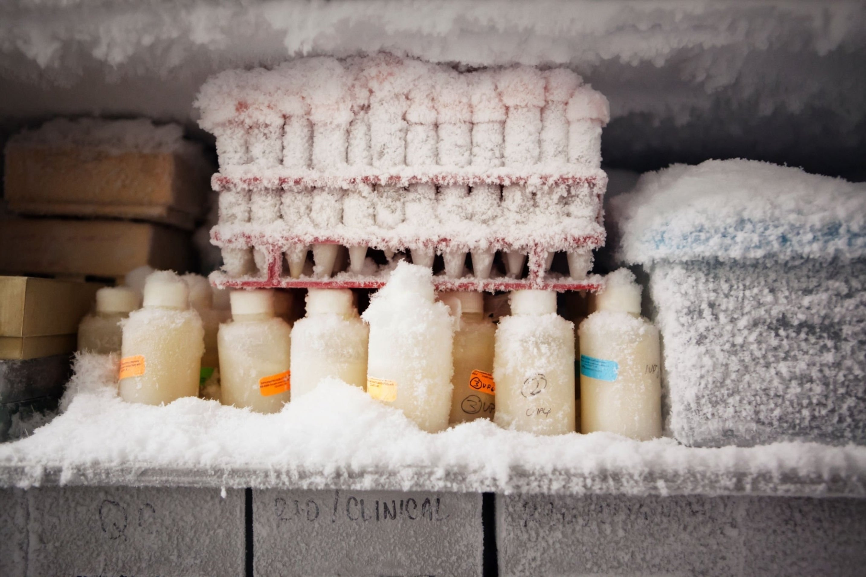 Exploring the Differences Between Auto and Manual Defrost Freezers FC