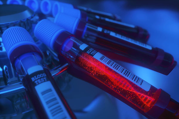 Common Mistakes in Centrifuge Tube Usage and How to Avoid Them