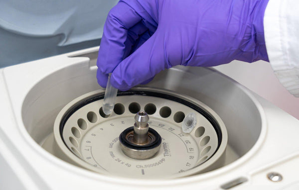 Types of Centrifuges and Their Advantages