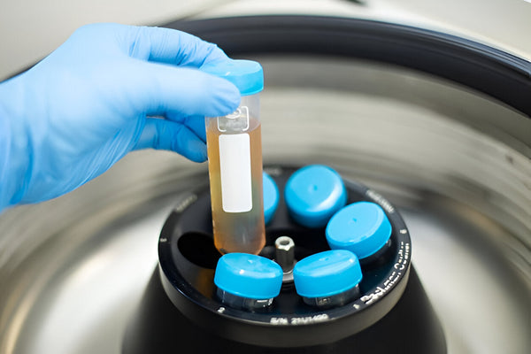 How to Select the Right Centrifuge for Your Application