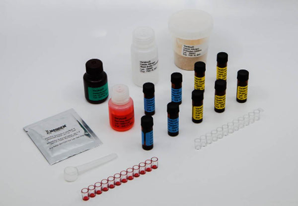 Veratox® for Casein